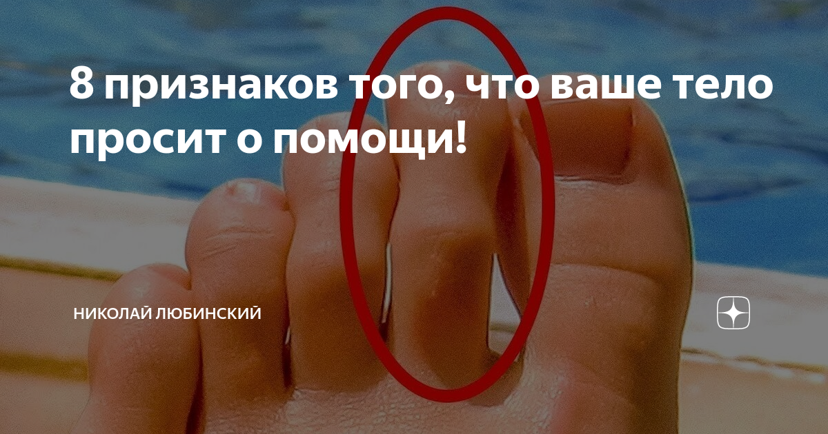 15 верных признаков того, что ты в токсичных отношениях